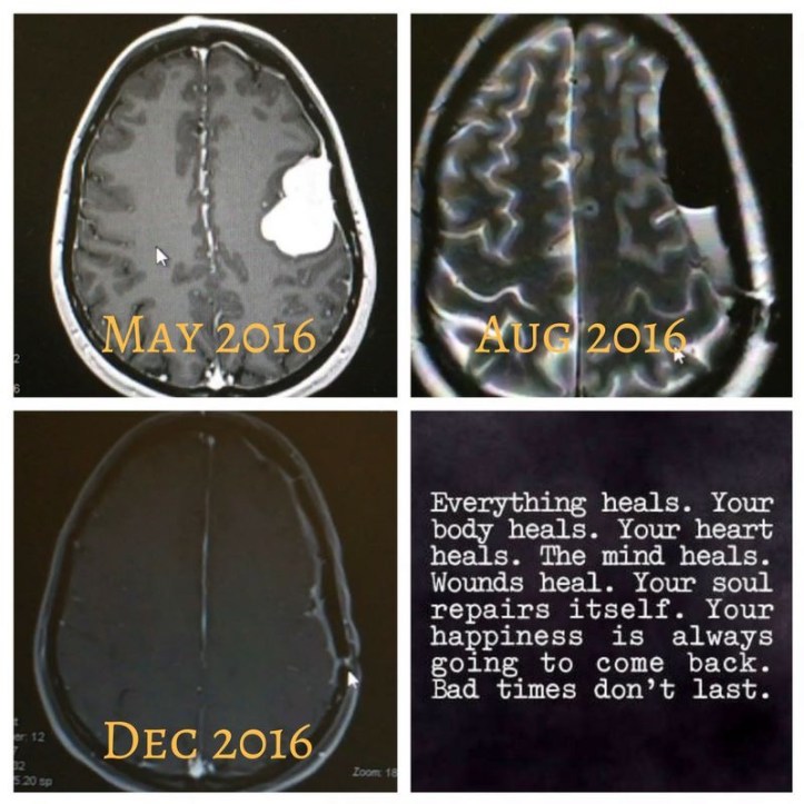 transformationtuesday